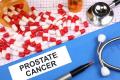 prostate cancer: best treatment for prostate cancer