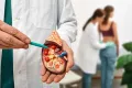 doctor pointing to a plastic diagram of a kidney stone