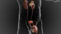 Shockwave-Therapy-Education-with-Urologist-Kia-Michel-MD