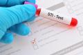 Sexually transmitted disease test