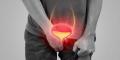 man with pain from bladder stones
