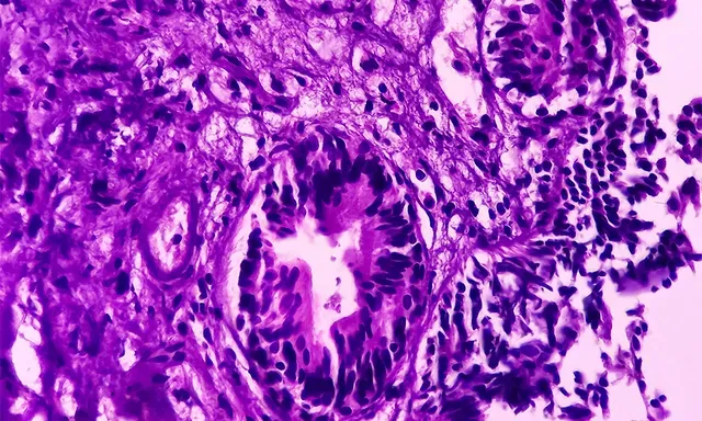 a purple closeup image of tissue