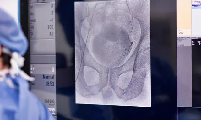 x-ray of the torso and pelvic area