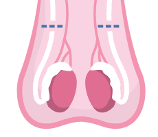 an illustration of testicles with lines showing vasectomy site