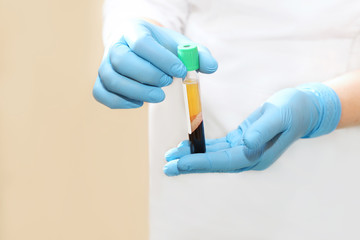 PRP vial used in P Shot for male enhancement